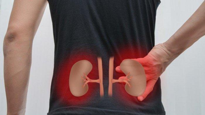 Dinas Kesehatan Klaim Ada Anak di Kota Medan yang Sudah Terkena Ginjal Akut, Ini Ciri dan Gejalanya