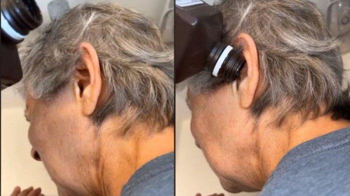 Syoknya Ibu ini, Awalnya Keluhkan Telinga Sakit, Diteteskan Cairan Kaki Panjang Merangkak Keluar