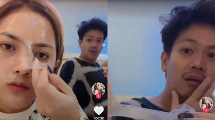Detik-detik Istri Prank Suami, Kulit Wajahnya Terkelupas hingga Suami Spontas Lari