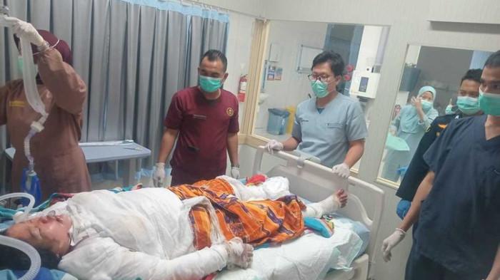Jumiatun korban kecelakaan bus ALS yang mengalami luka bakar