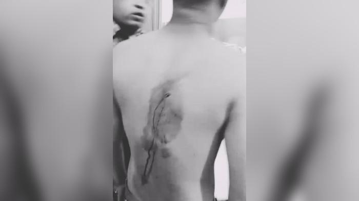 KORBAN TAWURAN- Januar Lubis (16) yang merupakan warga Belibis IV itu mengalami luka bacok di bagian paha dan punggung hingga harus mendapatkan penanganan medis di klinik terdekat. Diduga korban menjadi salah sasaran kelompok tawuran. Minggu (28/6/2026).