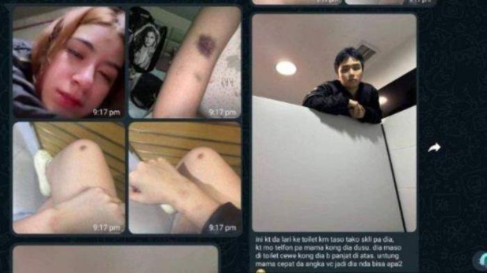 Kelakuan Mengerikan Leon Dozan,Nekat Kejar Rinoa yang Babak Belur Sampai Panjat Tembok Toilet Wanita