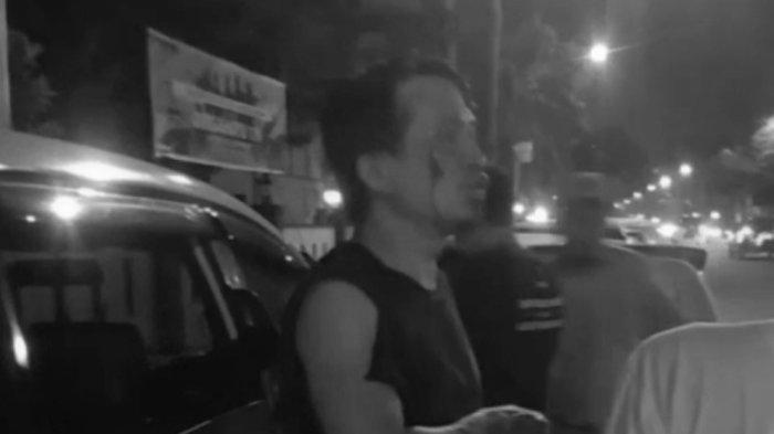 Gegara Tegur Penumpang Muntah Berceceran, Sopir Taksi Online di Medan Babak Belur Dikeroyok