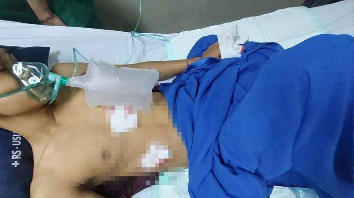 Periksa Sejumlah CCTV, Polsek Sunggal Ungkap Pelaku Begal di Ngumban Surbakti Diduga Dua Orang