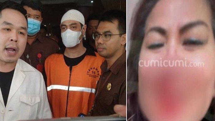 Kronologi Dugaan KDRT Ferry Irawan versi Dakwaan Jaksa, Terkuak Penyebab Hidung Venna Berdarah