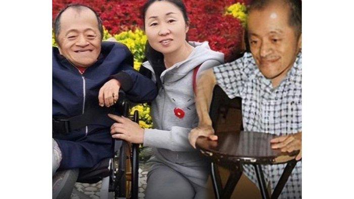 Lelaki Alami Kelainan Tulang, Usia 60 Tahun Beratnya Hanya 25 Kg, Beruntung Dapat Cinta yang Tulus