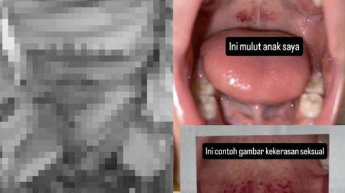 NASIB Bapak Kos di Balikpapan Lecehkan Bayi 2 Tahun, Ibu Korban Diancam, Sang Anak Depresi Kesakitan