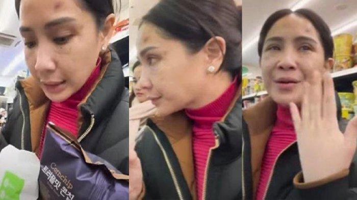 Nagita Slavina Operasi Plastik di Korsel? Wajah Bengkaknya Viral hingga Disebut Mirip Sarwendah