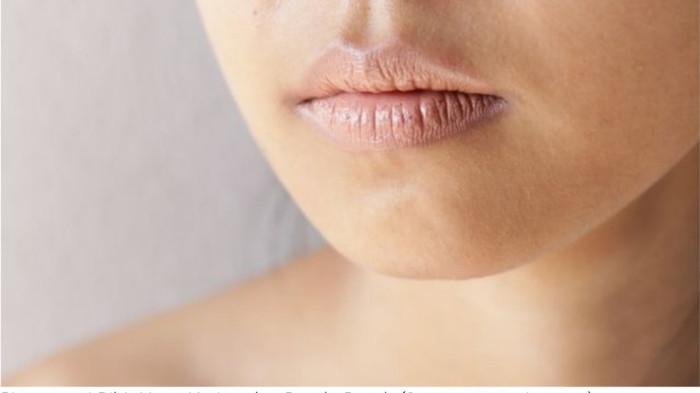  Pigmentasi Bibir Yang Kering dan Pecah-Pecah (Source: post pinterest)