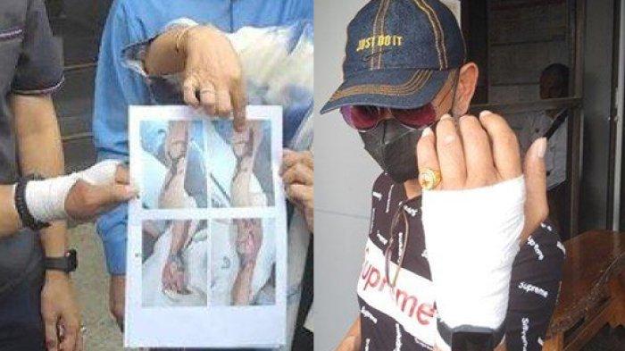 PILU Pria di Palembang Alami Diare tapi Berakhir Tangan Membusuk Usai Diinfus, Diduga Malpraktik