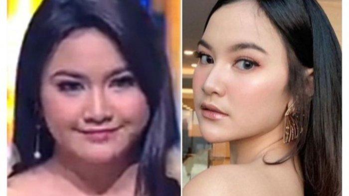 Potret Perbedaan Mahalini Dulu dan Sekarang Beda, Dulunya Sering Dicibir Mirip Ibu-ibu