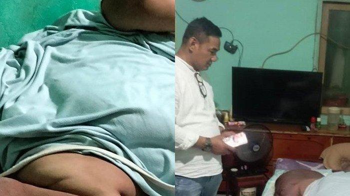 SOSOK Engky Pemuda 200 Kg, Obesitas Sejak 2023, Tulang Punggung Keluarga Kini tak Bisa Lagi Bergerak
