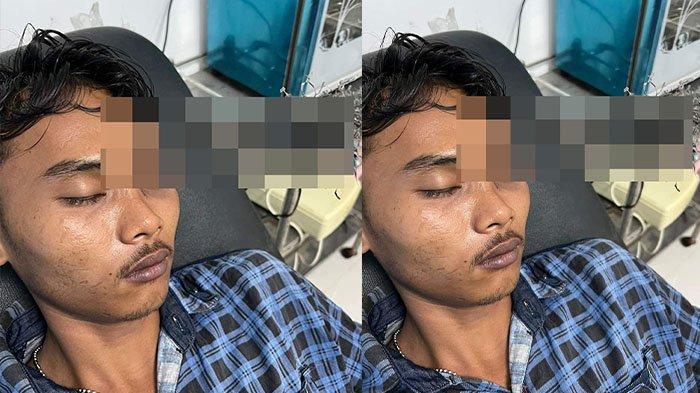 Serem Banget Nih, Anak Panah Menancap di Kening, Tawuran di Belawan Akibat Saling Ejek