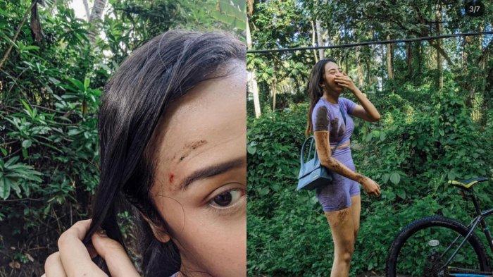 Anya Geraldine Jatuh dari Sepeda, Pelipis Mata Kanan Sobek & Berdarah, Langsung Jadi Sorotan Netizen