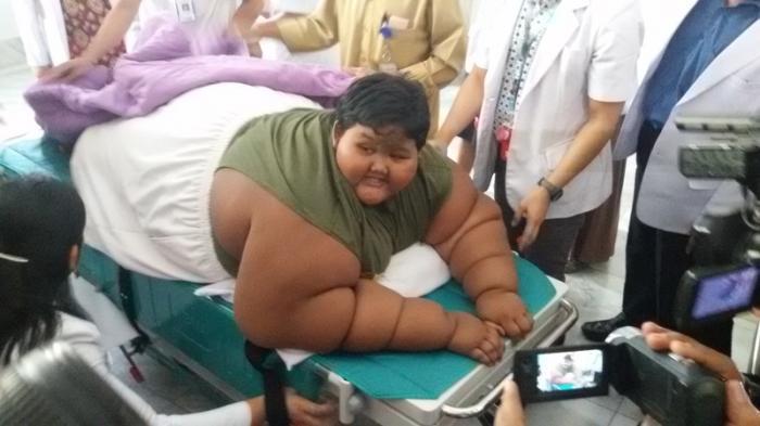 Empat Hari, Bobot Arya Permana Berkurang Tiga Kilogram
