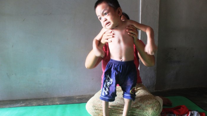 Arlan Bocah Lumpuh Tak Digubris Pihak Rumah Sakit meski Menggunakan Kartu BPJS