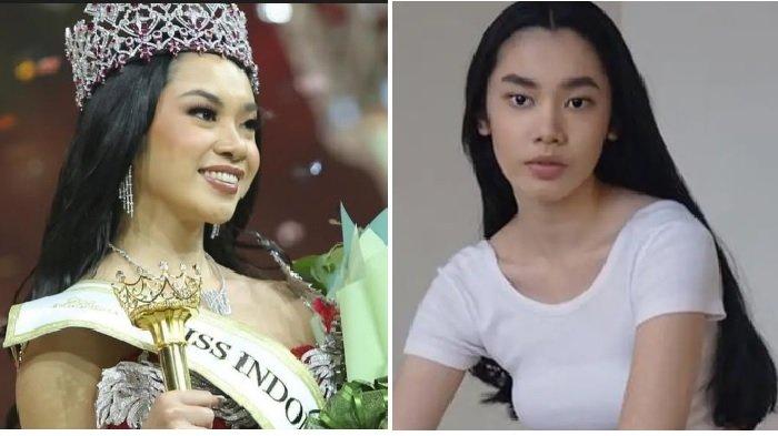 Mengenal Sosok Audrey Bianca, Pemenang Miss Indonesia 2025, Dulu Tak Bisa Potong Kuku Sendiri