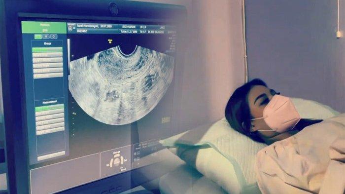 Aurel Mengidap Penyakit Kista, Jeslin (19) Bertanya ke Dokter: Apakah Wanita Perawan Mengidap Kista?