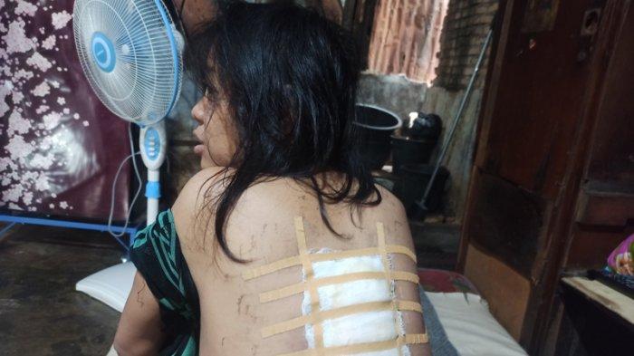 Berjuang Lawan Bisul Raksasa, Ayen Hanya Bisa Tiduran di Kasur Usang, Air Tak Mengalir di Rumah