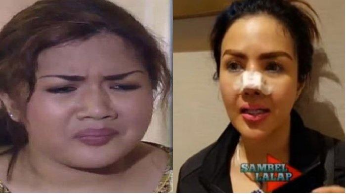 Yalangoch xolalarning kokraklari