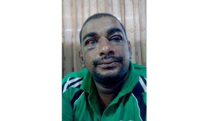 Istri Rakesh Minta Polisi Tujukkan Korban Pemukulan Suaminya: Mana Buktinya, Siapa Korbannya?