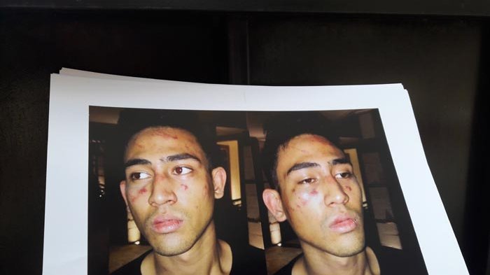 Axel Matthew Mendekam Tahanan, Begini Curahan Hati Sang Ibunda, Ina Thomas