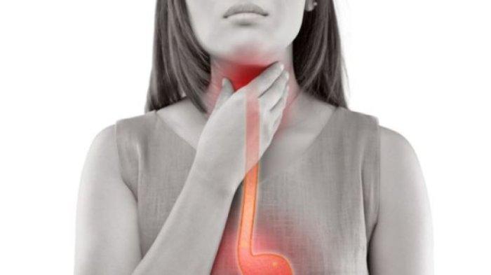 GEJALA  Asam Lambung, Tips Mengatasi GERD, Cara Gunakan Antasida yang Benar