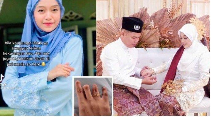 Punya Cacat Jari Buntung, Wanita Ini Sempat Malu Nikah, Akhirnya Ada Calon Suami Mau Pasang Cincin