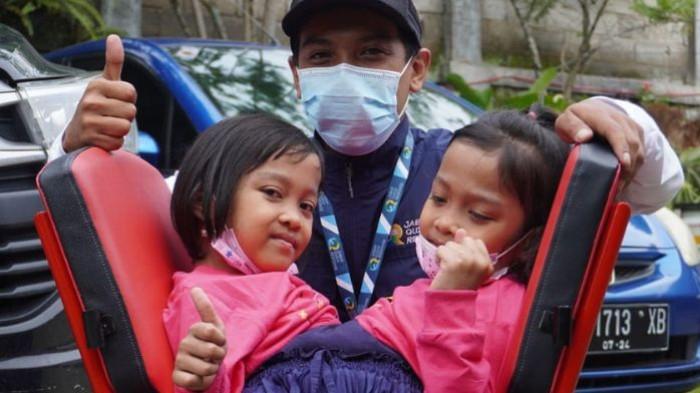 kembar siam Dewi dan Putri