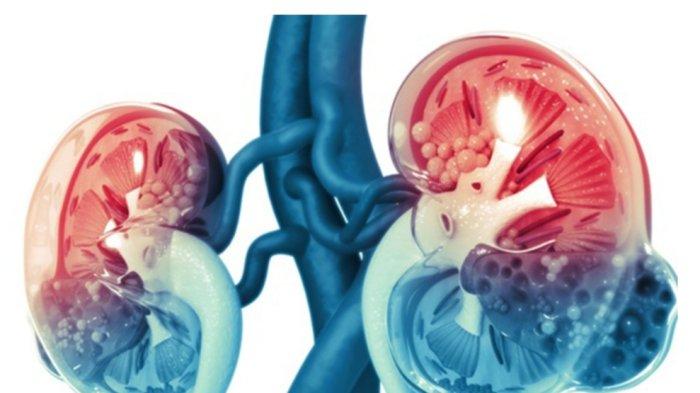 Terkait Penghentian Sementara Penjualan Paracetamol Sirup, Dinkes Medan Tunggu Arahan Kemenkes