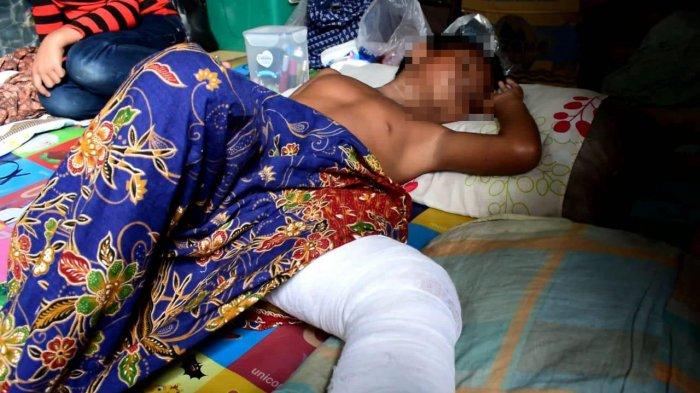 Begini Kronologis hingga MAS Dipaksa Minum Air Kencing dan Kakinya Dibakar