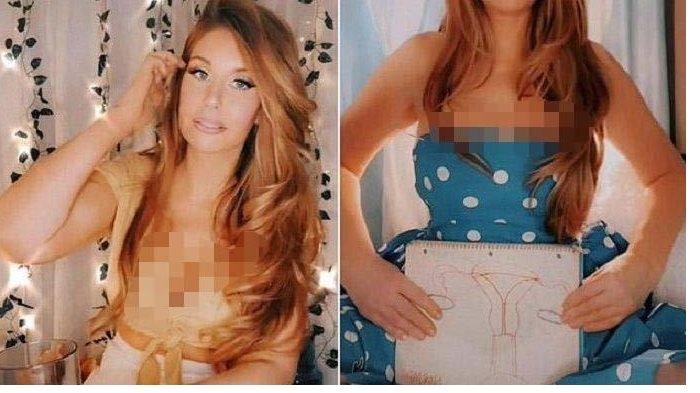 WANITA Berusia 37 Tahun Ini Miliki Keunikan, Punya 2 Alat Kelamin dan 2 Rahim, Tersiksa saat Haid