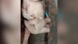 Bayi-Lahir-Dengan-Enak-Kaki.jpg