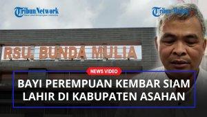 Bayi-kembar-siam-lahir-di-asahan.jpg