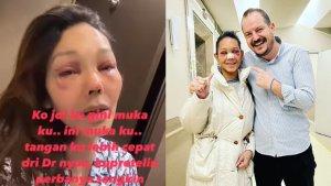 Bunda-Corla-pamer-wajah-baru-usai-oplas.jpg