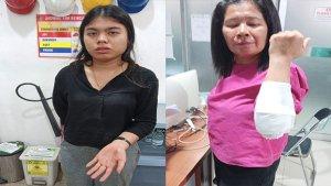 Ibu-Anak-Korban-Jambret.jpg