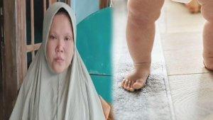 KRONOLOGI-Kepala-Bayi-Tertinggal-di-Rahim-Ibunya-Keluarga-Lapor-Polisi-Dinkes-Bangkalan-Buka-Suara.jpg