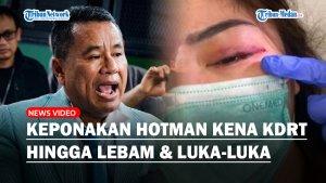 Keponakan-Hotman-Paris-Jadi-Korban-KDRT-Pelipis-Mata-Berdarah-Suami-Ditahan-Polisi.jpg