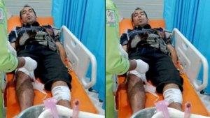 Korban-Muhammad-Ikhwan-Sembiring-setelah-diterkam-Harimau-Sumatera.jpg