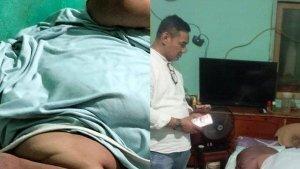 SOSOK-Engky-Pemuda-200-Kg-Obesitas-Sejak-2023-Tulang-Punggung-Keluarga-Kini-tak-Bisa-Lagi-Bergerak.jpg
