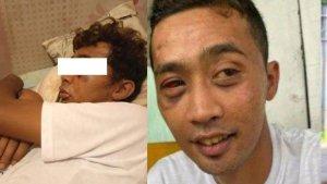 SOSOK-Mas-Iwan-Pengamen-Keterbelakangan-Mental-Dipukul-dan-Dikencingi-Uang-Dirampas-Wajah-Memar.jpg