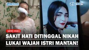 Seorang-perempuan-tega-melukai-wajah-istri-dari-mantan-kekasihnya.jpg