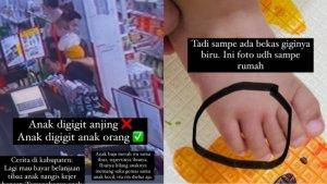 Viral-curhat-orangtua-usai-kaki-sang-anak.jpg