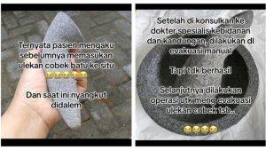 Wanita-mengalami-kesakitan-setelah-ulekan-cobek-yang-dimasukkan-ke-alat-kelaminnya-tak-bisa-keluar.jpg
