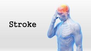 ilustrasi-stroke.jpg