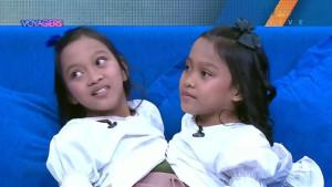 kembar-siam-Dewi-dan-Putri-sehat.jpg