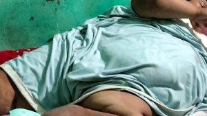 ngky-berusia-33-tahun-alami-obesitas-hingga-200-kiligram.jpg