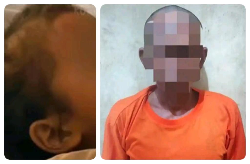 Balita-meninggal-usai-Dirudapaksa.jpg