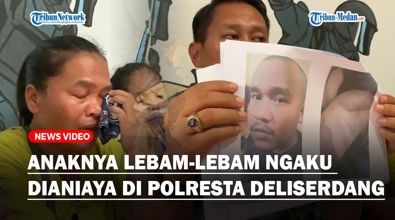Ibu-ini-Lihat-Anaknya-Lebam-lebam-Ngaku-Dianiaya-di-Polresta-Deliserdangss.jpg