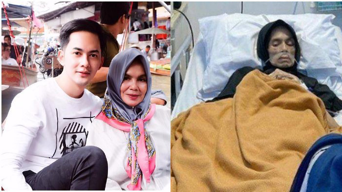 Ibunda-Kiki-Farrel-sedang-sakit-kanker.jpg